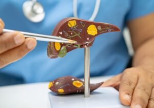 Which Ayurvedic Liver Tonic Syrup Works Best for Fatty Liver